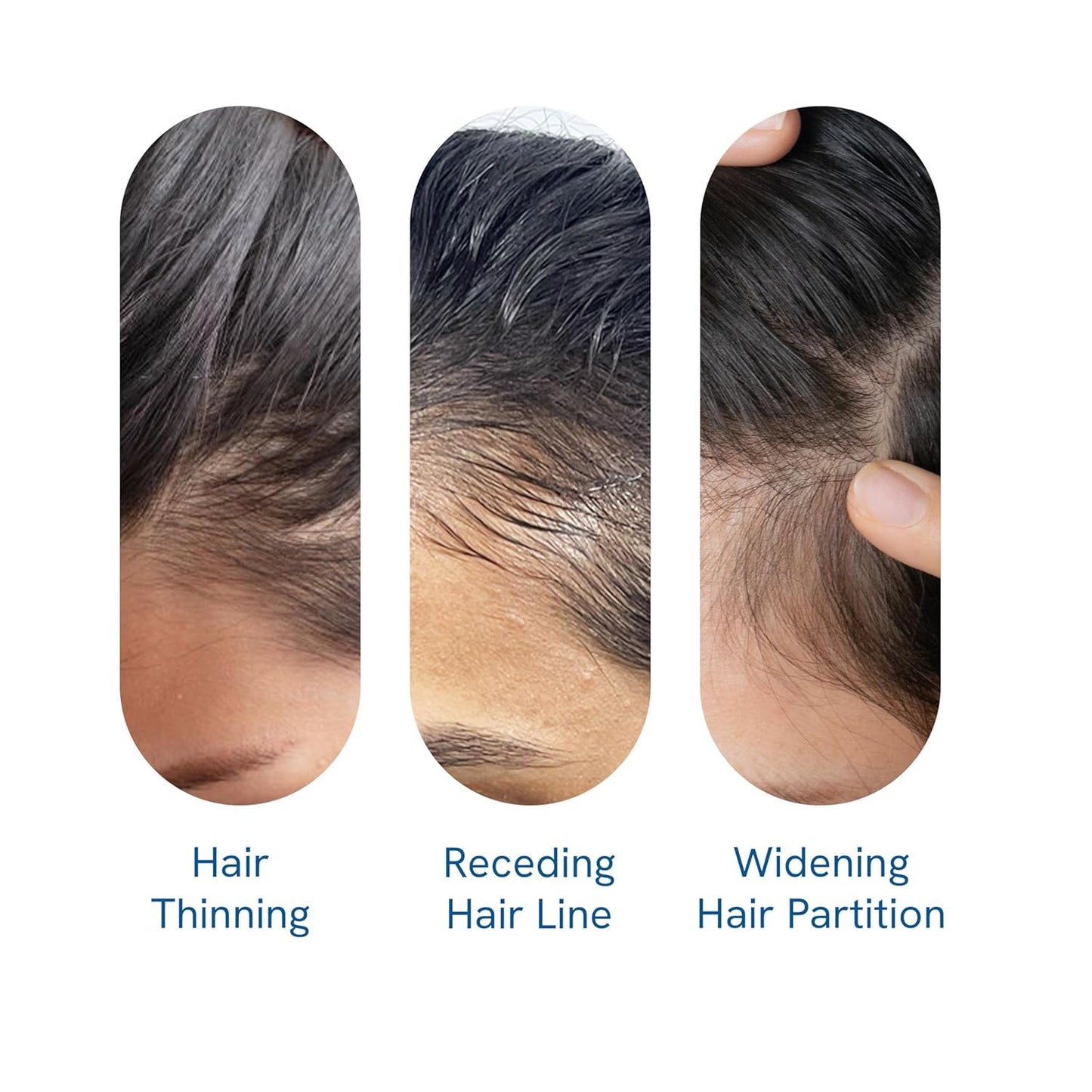 Hair Growth Serum with Rosemary Oil and Peptide Complex