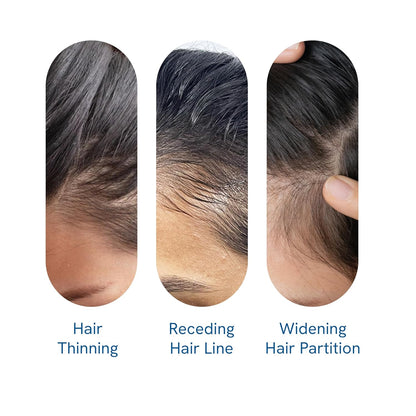 Hair Growth Serum with Rosemary Oil and Peptide Complex
